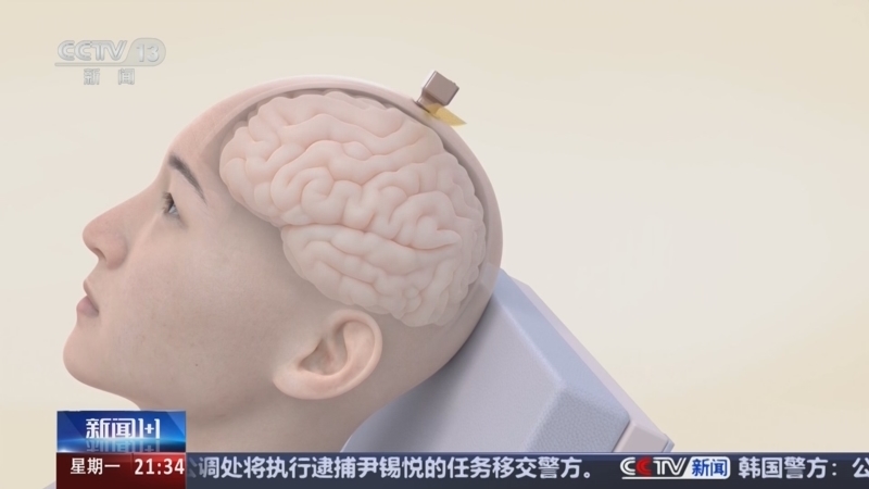 新闻1+1 《新闻1+1》 20250106 脑机接口，又有新突破？