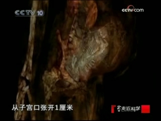 走近科学 漫长的分娩