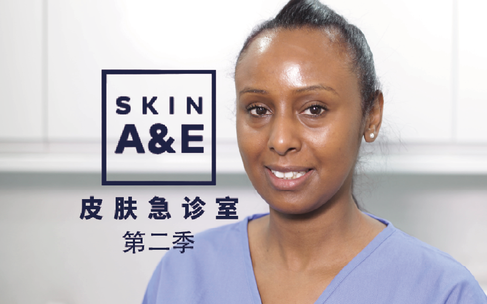 锁骨上的脂肪瘤