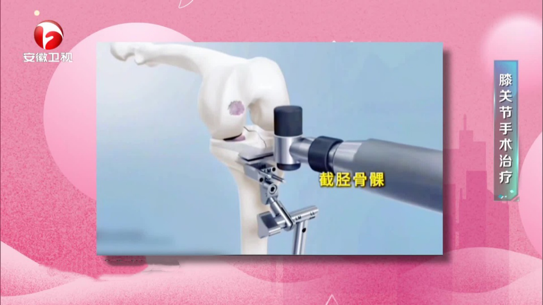 且行且珍“膝”