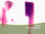 走近科学 《走近科学》 20150616 超级细菌请遵医嘱
