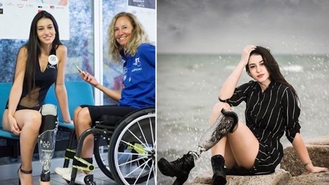 涨健识 最美残疾少女夺选美比赛冠军，却遭遇网络暴力