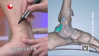 名医话养生_20210623_别小看崴脚