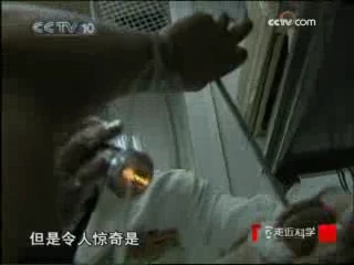 走近科学 正中眉心的球拍