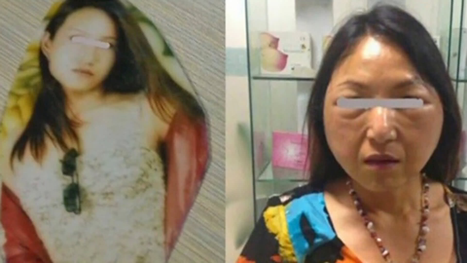 最佳选择 三天学会割双眼皮野生整容师整死你