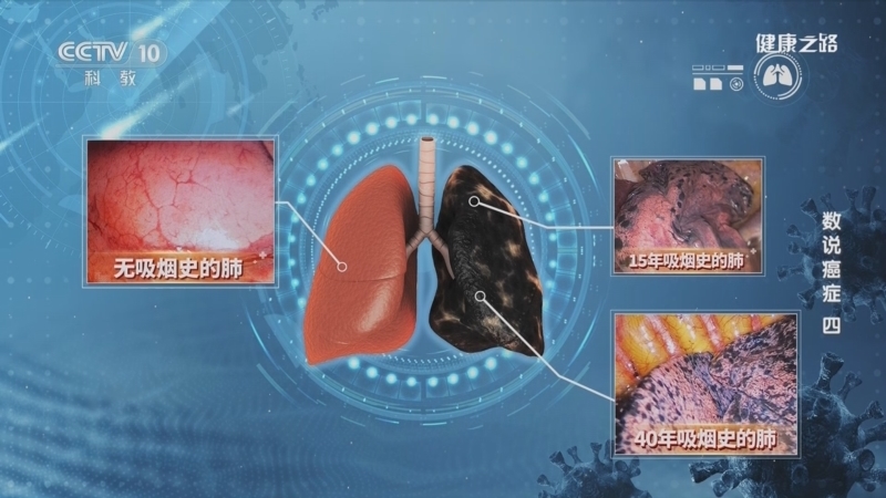 健康之路 《健康之路》 20230421 数说癌症（四）