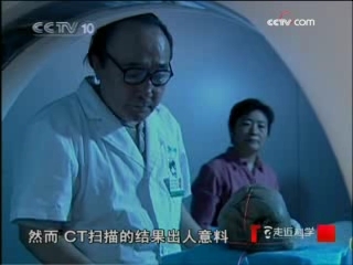 走近科学 开颅背后的秘密