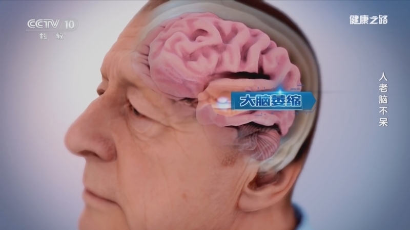 健康之路 《健康之路》 20241229 人老脑不呆