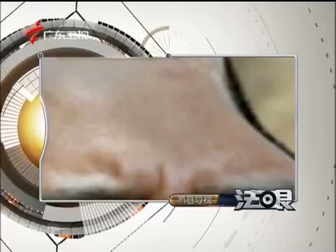 法眼 《法眼》 20140910 工伤之后