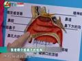 我爱每一天 《我爱每一天》20110426：赶走春季鼻炎困扰