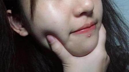 身体辣么大, 痘痘为什么偏偏喜欢长在脸上?