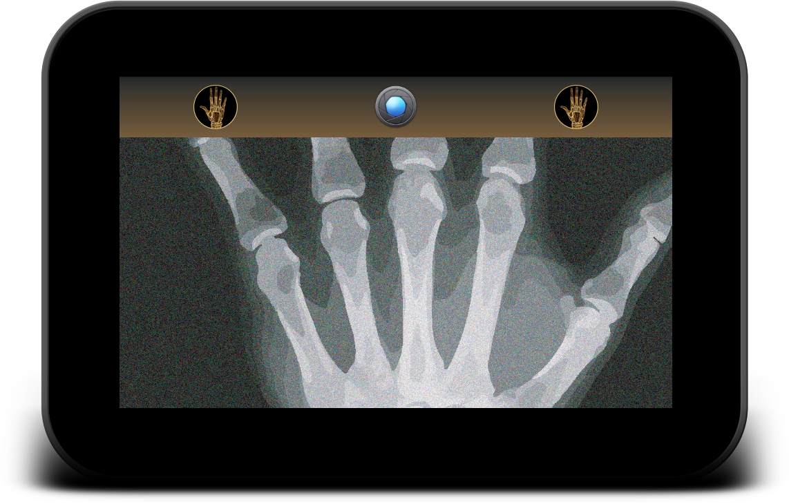 x射线扫描仪专业摄像机