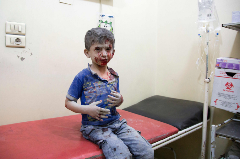 战争儿童伤害图片